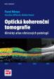 Optická koherenční tomografie - Klinický atlas sítnicových patologií