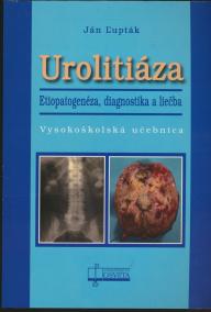 Urolitiáza. Etiopatogenéza, diagnostika a liečba